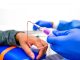 Sickle Cell